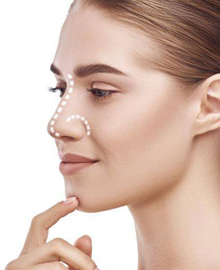 Rinoplastia-facial