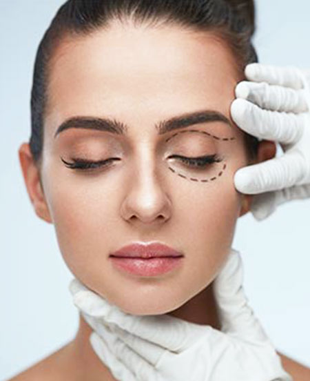 blefaroplastia-facial